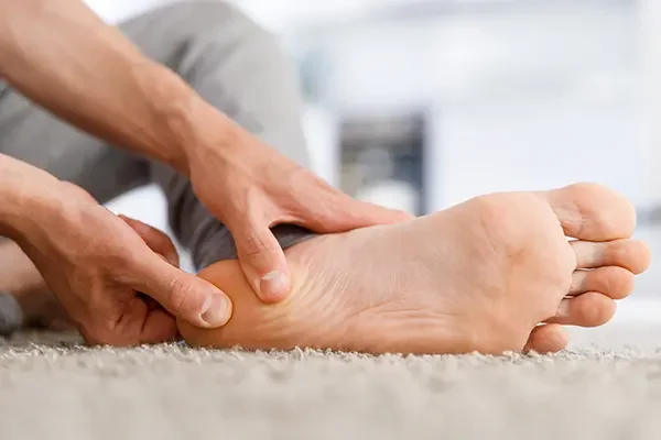 fascitis plantar